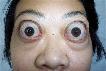 吃瓜捏爆眼球视频下载免费,轻松获取热门内容!  第2张 吃瓜捏爆眼球视频下载免费,轻松获取热门内容!  第2张